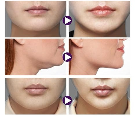 Kit Liftox - Adhesivo de Estiramiento Facial 120pcs